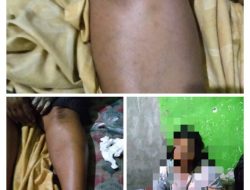 Ojek Online Mobile Tabrak Lari Ibu Paru Baya