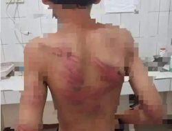 Kak Seto Kemana Ya…? LPAI Tolong Orang Tua Anak di Nabire- Papua Barat Ini Butuh Bantuan