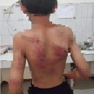 Kak Seto Kemana Ya…? LPAI Tolong Orang Tua Anak di Nabire- Papua Barat Ini Butuh Bantuan