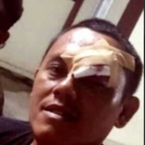 Ketua FPII Jabar, Stop kriminalisasi Terhadap Jurnalis Segera Tangkap Pelaku