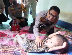 Kapolres Ketapang Kunjungi Pirman Apadil, Balita Penderita Hidrosefalus Di Desa Sungai Awan Kanan
