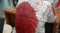 Ketua Pewarna Jabar Kefas Hervin, Kena Begal Oleh Sekelompok Genk Motor di Jati Asih G.Putri