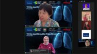 Kemendagri Dukung Perencanaan dan Penganggaran Penanggulangan Tuberkulosis
