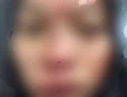 Tiang Internet Memakan Korban di Cikembar, Satu Orang Pengendara Sepeda Motor Luka Parah di Kepala