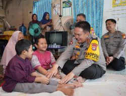 Dibiayai Jenderal Bintang 2, Adik-Kakak Penderita Tulang Kaca di Pekanbaru Berangsur Pulih