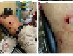 Kapolsek Cijeruk Mengungkap Kronologi Pengeroyokan di Simpang Cigombong: Pelaku Masih Dalam Pencarian