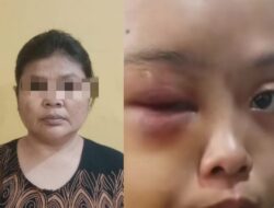 Sadis, Anak Yatim Dipukuli dan Diinjak Tantenya Hingga Alami Luka di Tarai Bangun