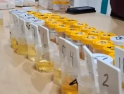 Lapas Cilegon Gelar Tes Urine Pegawai dan WBP : Bukti Nyata Komitmen Bersama Ciptakan Lingkungan Pemasyarakatan yang Bersih dan Bermartabat